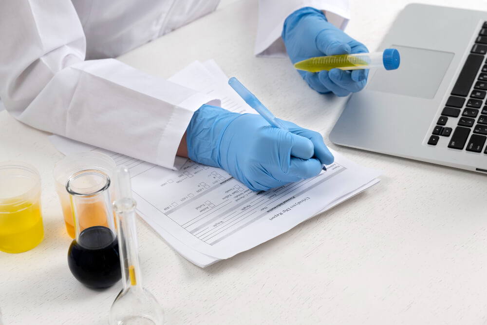 Find Out What Urine Test Can Detect