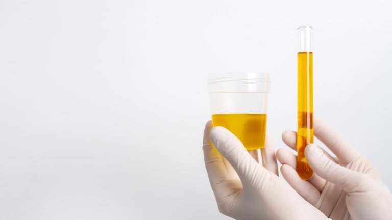 medical check up urine test